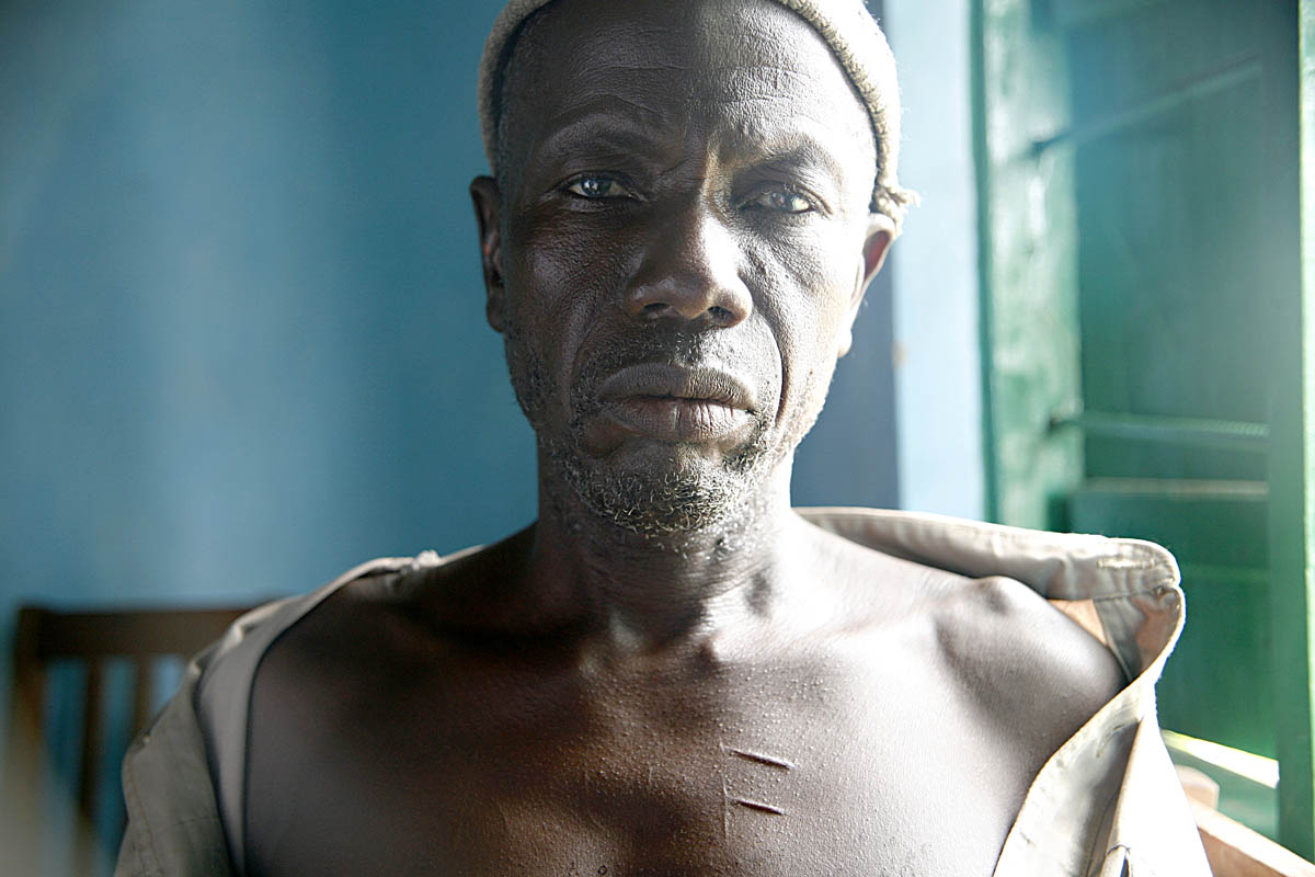 A man who was captured by rebels during the war displays the tattoo they etched on to his chest -- the intials R.U.F., for Revolutionary United Front.